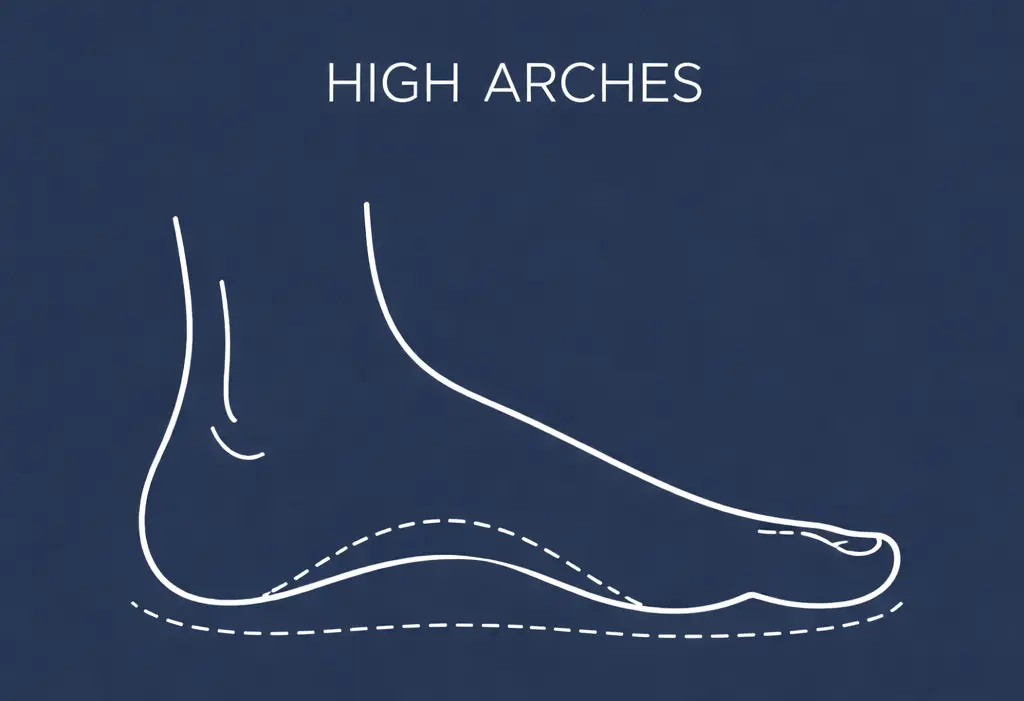 high-arch-foot